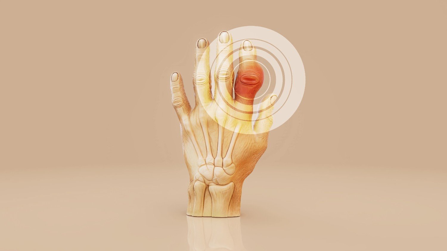 Best Rheumatology Treatment in Gurgaon