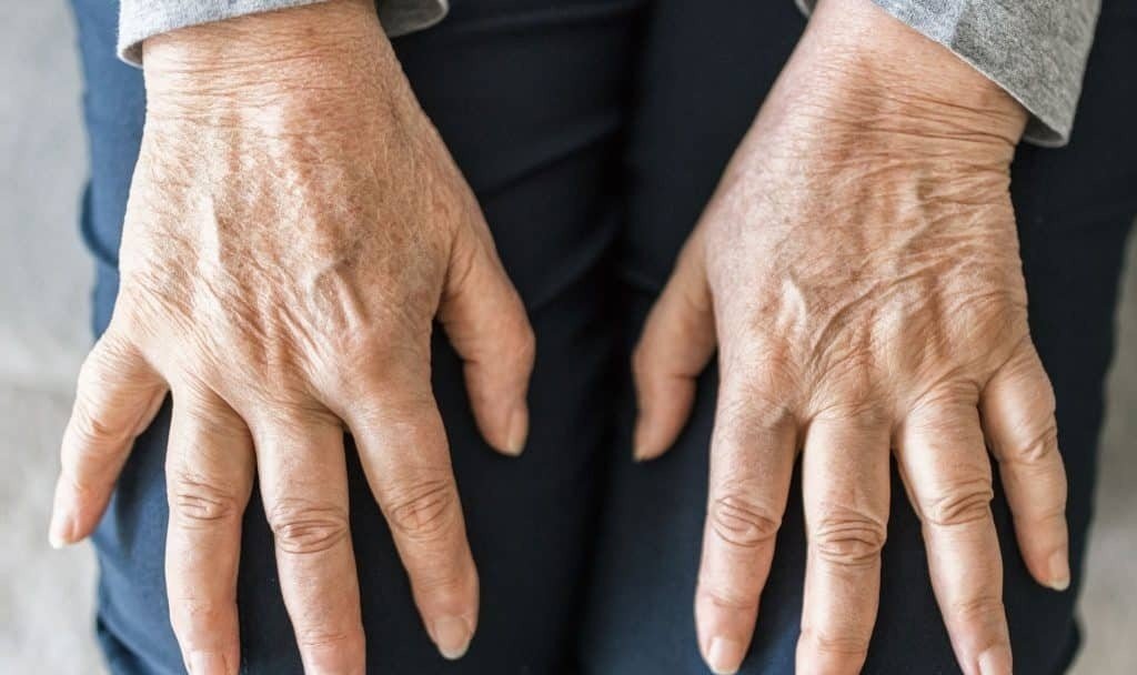 Best Rheumatoid Arthritis Specialist in Gurgaon