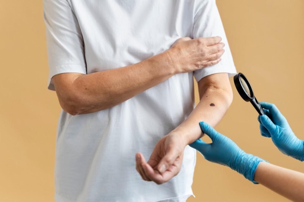 Best Scleroderma Doctor in Gurugram